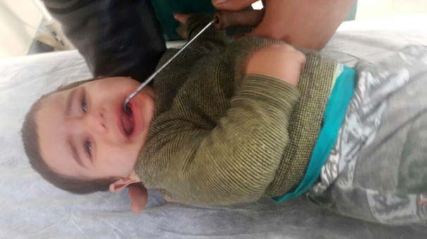 Antalya’da Akıl Almaz Olay! 9 Aylık Bebeğin Ağzına Soba Demiri Saplandı