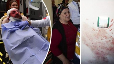 Adana’da Korkunç Olay! Boşandığı Kocasının Yüzüne Kızgın Yağ Döküp Kafasına Satırla Vurdu