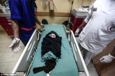 İsrail'in Gazze Saldırısının Ardından Yürek Yakan Görüntüler! Minicik Bedenleri ile Hastane Sedyelerinde…