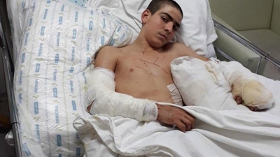 İzmir’de Pitbull Dehşeti! 12 Yaşındaki Çocuk Ölümden Döndü