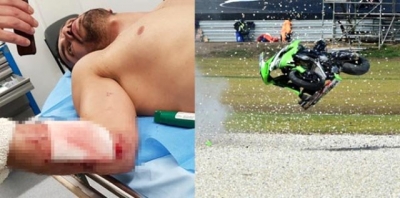 Milli Motosikletçi Kenan Sofuoğlu, 257 KM Hızla Giderken Kaza Yaptı, Yaralı Olarak Hastaneye Kaldırıldı